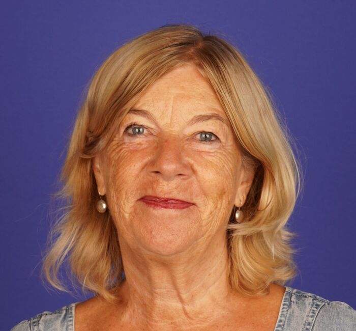 Duerst Johanna niedrig